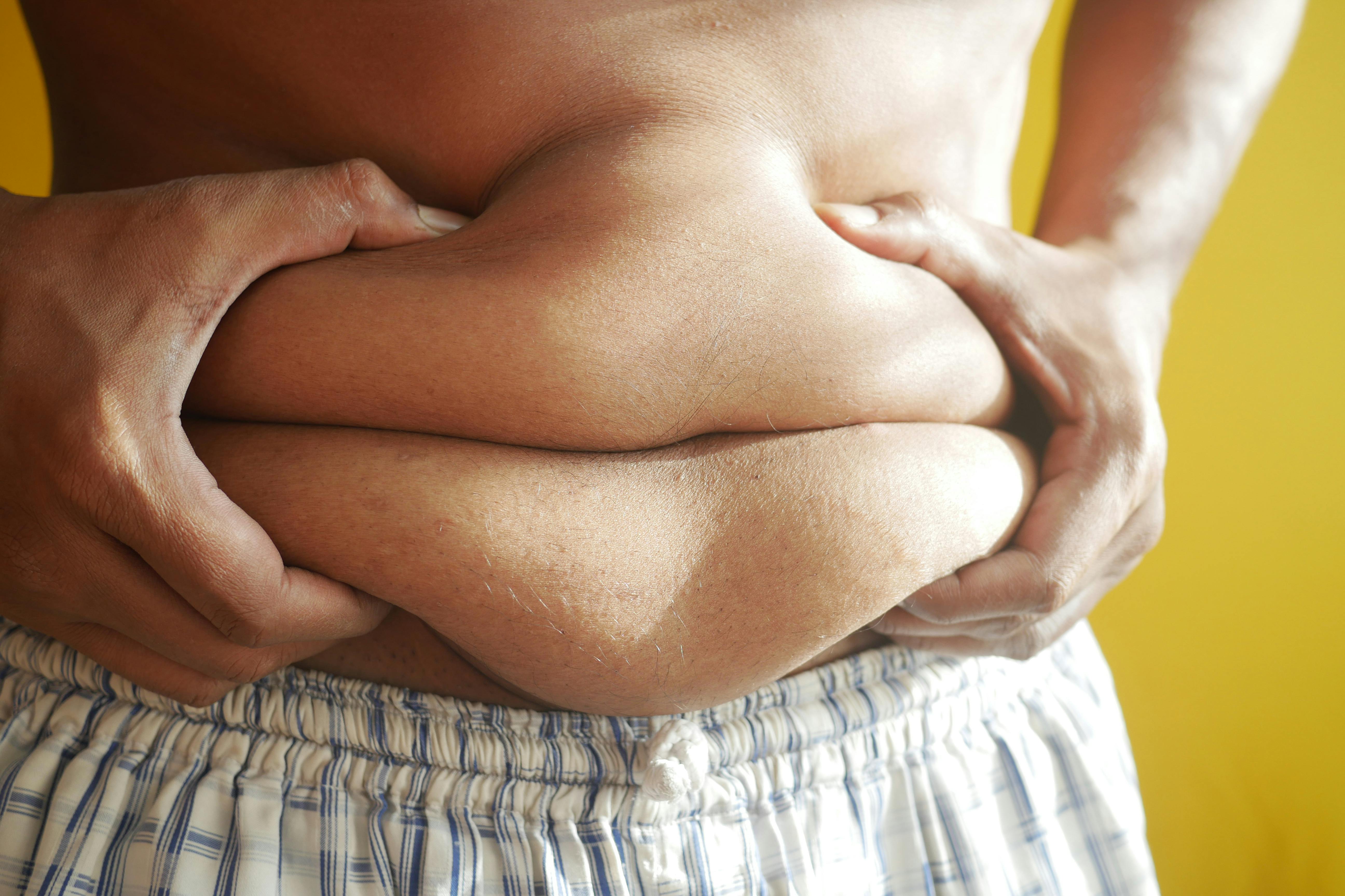 Giornata Mondiale dell'obesità